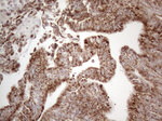 DLX4 Antibody in Immunohistochemistry (Paraffin) (IHC (P))