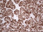 DLX4 Antibody in Immunohistochemistry (Paraffin) (IHC (P))