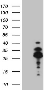 DLX4 Antibody in Western Blot (WB)