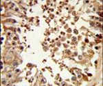 DMC1 Antibody in Immunohistochemistry (IHC)