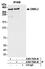 DMXL2 Antibody in Western Blot (WB)