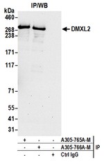 DMXL2 Polyclonal Antibody