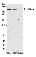 DMXL2 Polyclonal Antibody