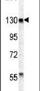DNA2 Antibody in Western Blot (WB)