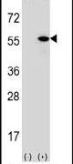 HDJ2 Antibody in Western Blot (WB)