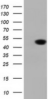 DNAJA2 Antibody in Western Blot (WB)