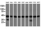 DNAJA2 Antibody in Western Blot (WB)