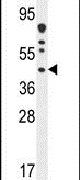 DNAJC22 Antibody in Western Blot (WB)