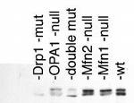 DNM1L Antibody in Western Blot (WB)