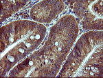 DNM1L Antibody in Immunohistochemistry (Paraffin) (IHC (P))