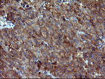 DNM1L Antibody in Immunohistochemistry (Paraffin) (IHC (P))