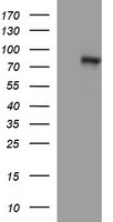 DNM1L Antibody in Western Blot (WB)
