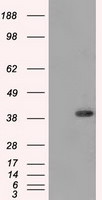 DNTTIP1 Antibody in Western Blot (WB)