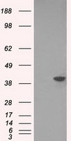DNTTIP1 Antibody in Western Blot (WB)