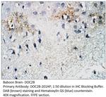 DOC2B Antibody in Immunohistochemistry (IHC)