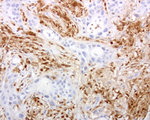 DOCK2 Antibody in Immunohistochemistry (Paraffin) (IHC (P))
