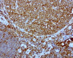 DOCK2 Antibody in Immunohistochemistry (Paraffin) (IHC (P))