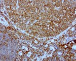 DOCK2 Antibody in Immunohistochemistry (Paraffin) (IHC (P))