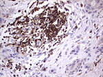 DOCK2 Antibody in Immunohistochemistry (Paraffin) (IHC (P))