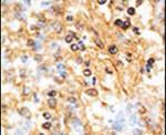 DOK1 Antibody in Immunohistochemistry (IHC)