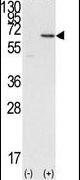 DOK1 Antibody in Western Blot (WB)