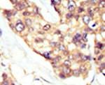 DOK5 Antibody in Immunohistochemistry (IHC)