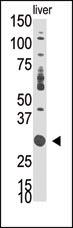 DOK5 Antibody in Western Blot (WB)