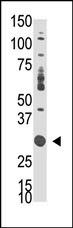 DOK5 Antibody in Western Blot (WB)