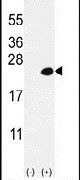 DOK5 Antibody in Western Blot (WB)
