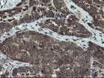 DOK7 Antibody in Immunohistochemistry (Paraffin) (IHC (P))