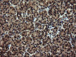 DOK7 Antibody in Immunohistochemistry (Paraffin) (IHC (P))