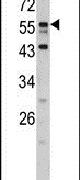 DONSON Antibody in Western Blot (WB)