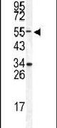 DONSON Antibody in Western Blot (WB)