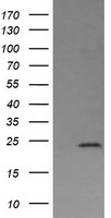 DPCD Antibody in Western Blot (WB)