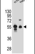 DPEP3 Antibody in Western Blot (WB)