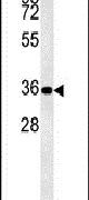 DPF3 Antibody in Western Blot (WB)
