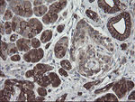 DPH2 Antibody in Immunohistochemistry (Paraffin) (IHC (P))