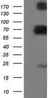 DPP3 Antibody in Western Blot (WB)