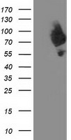 DPP3 Antibody in Western Blot (WB)