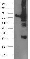 DPP3 Antibody in Western Blot (WB)