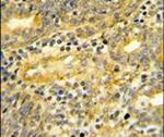 DPP8 Antibody in Immunohistochemistry (IHC)