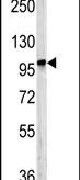 DPP8 Antibody in Western Blot (WB)