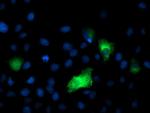 DPP9 Antibody in Immunocytochemistry (ICC/IF)