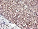 DPP9 Antibody in Immunohistochemistry (Paraffin) (IHC (P))