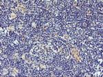 DPP9 Antibody in Immunohistochemistry (Paraffin) (IHC (P))