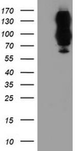 DPP9 Antibody in Western Blot (WB)