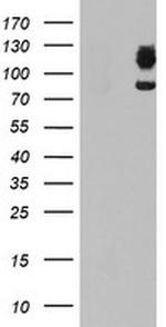 DPP9 Antibody in Western Blot (WB)