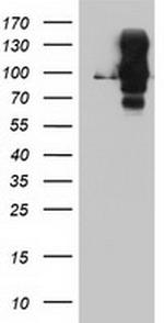 DPP9 Antibody in Western Blot (WB)