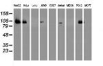 DPP9 Antibody in Western Blot (WB)