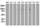 DPP9 Antibody in Western Blot (WB)